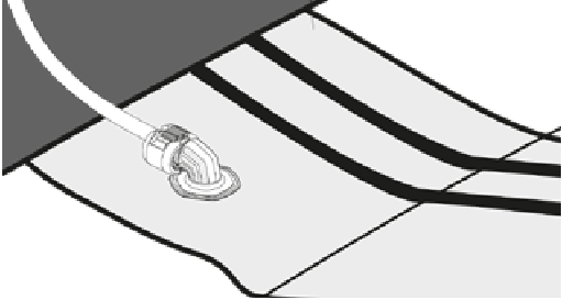 DUOTONE - Slick - DE STRUT-BLAZEN VERWIJDEREN - Stap 6 DE STRUT-BLAZEN VERWIJDEREN - Stap 6