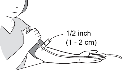 De armmanchet aanbrengen stap 3
