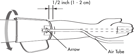 DE ARMMANCHET AANBRENGEN Stap 4