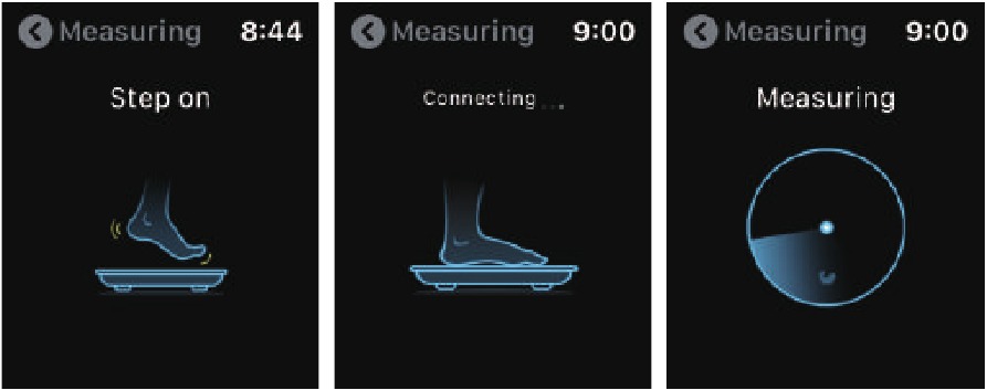 Apple Watch Stap 1