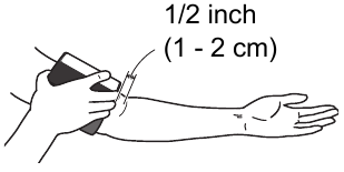 De armmanchet aanbrengen - Stap 1