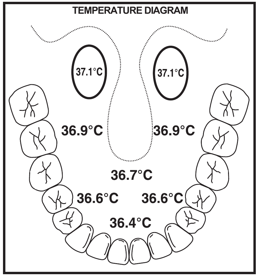TEMPERATUURDIAGRAM