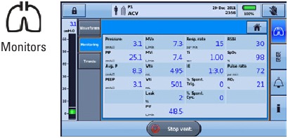 Golfvormen, Monitoring, Trends