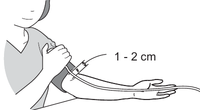 De armmanchet aanbrengen - Stap 2