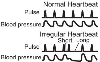 Hartslagdiagram