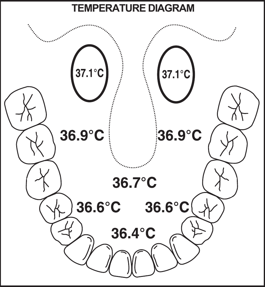 TEMPERATUURDIAGRAM