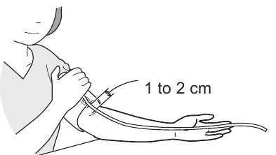 De armmanchet aanbrengen - Deel 2