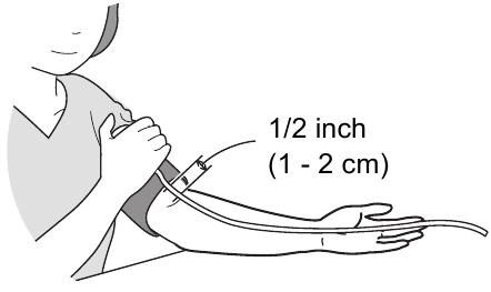De armmanchet aanbrengen - Stap 3