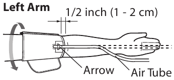 DE MANCHET AANBRENGEN - OP DE LINKERARM