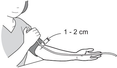 De armmanchet aanbrengen - Stap 2