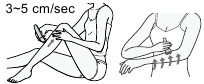 epileerrichting
