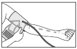 Plaatsing van de manchet op de arm