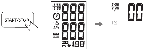 MEETPROCEDURE - Stap 2