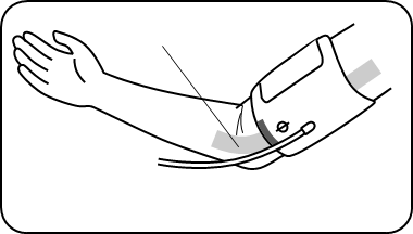 DE MANCHET AANBRENGEN - Stap 3