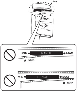 De armmanchet aanbrengen - Stap 4