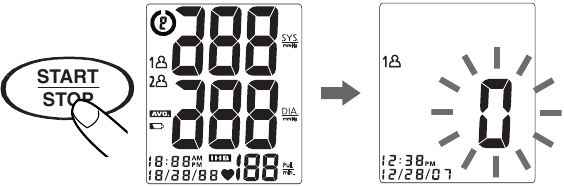 MEETPROCEDURE - Stap 2