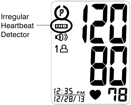 AANDUIDING ONREGELMATIGE HARTKLOPDETECTOR