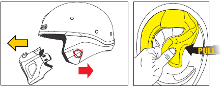 Comfortmouwset verwijderen - Stap 1