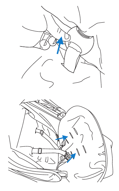 ZITVERKLEINER