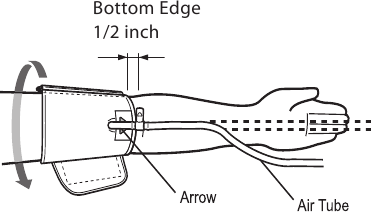 DE ARM MANCHET CORRECT AANBRENGEN