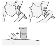 Oksels of bikinilijn epileren