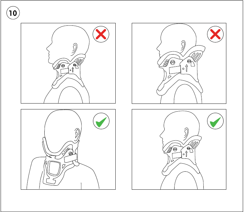 AANBRENGINSTRUCTIES - Checklist voor de definitieve pasvorm