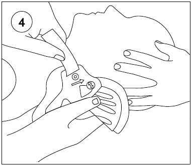 Toepassing in rugligging - Stap 1