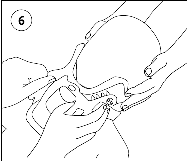 Toepassing in rugligging - Stap 3