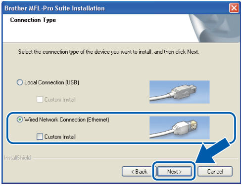 Bekabeld netwerk Win - Installeer MFL-Pro Suite - Stap 5